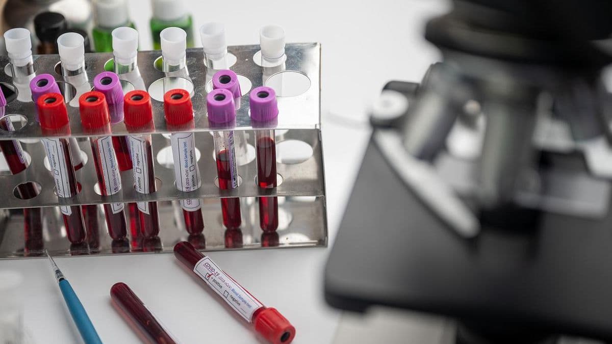 Вакцина против COVID-19 от AstraZeneca одобрена в ЕС в качестве бустерной