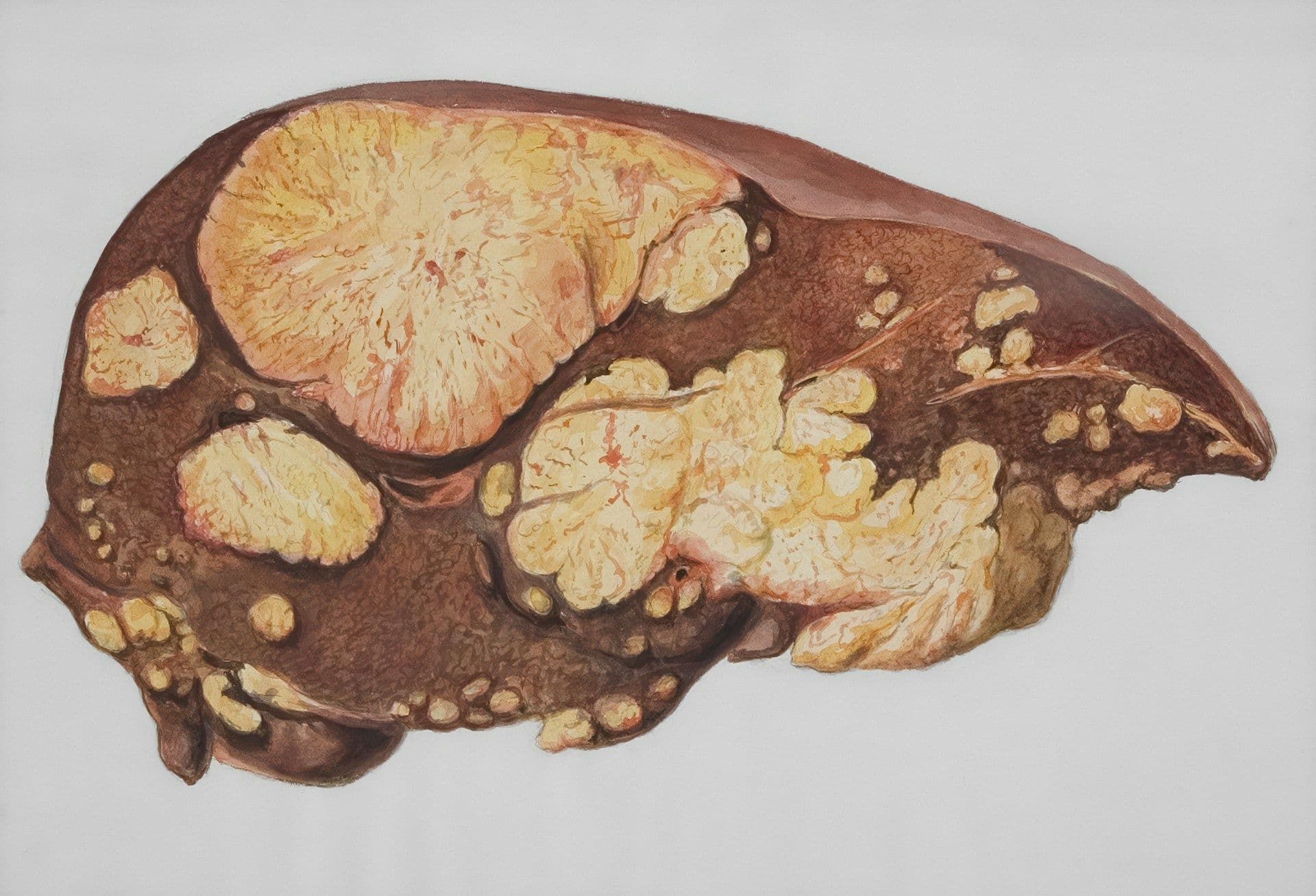 Hepatitis in Luxembourg