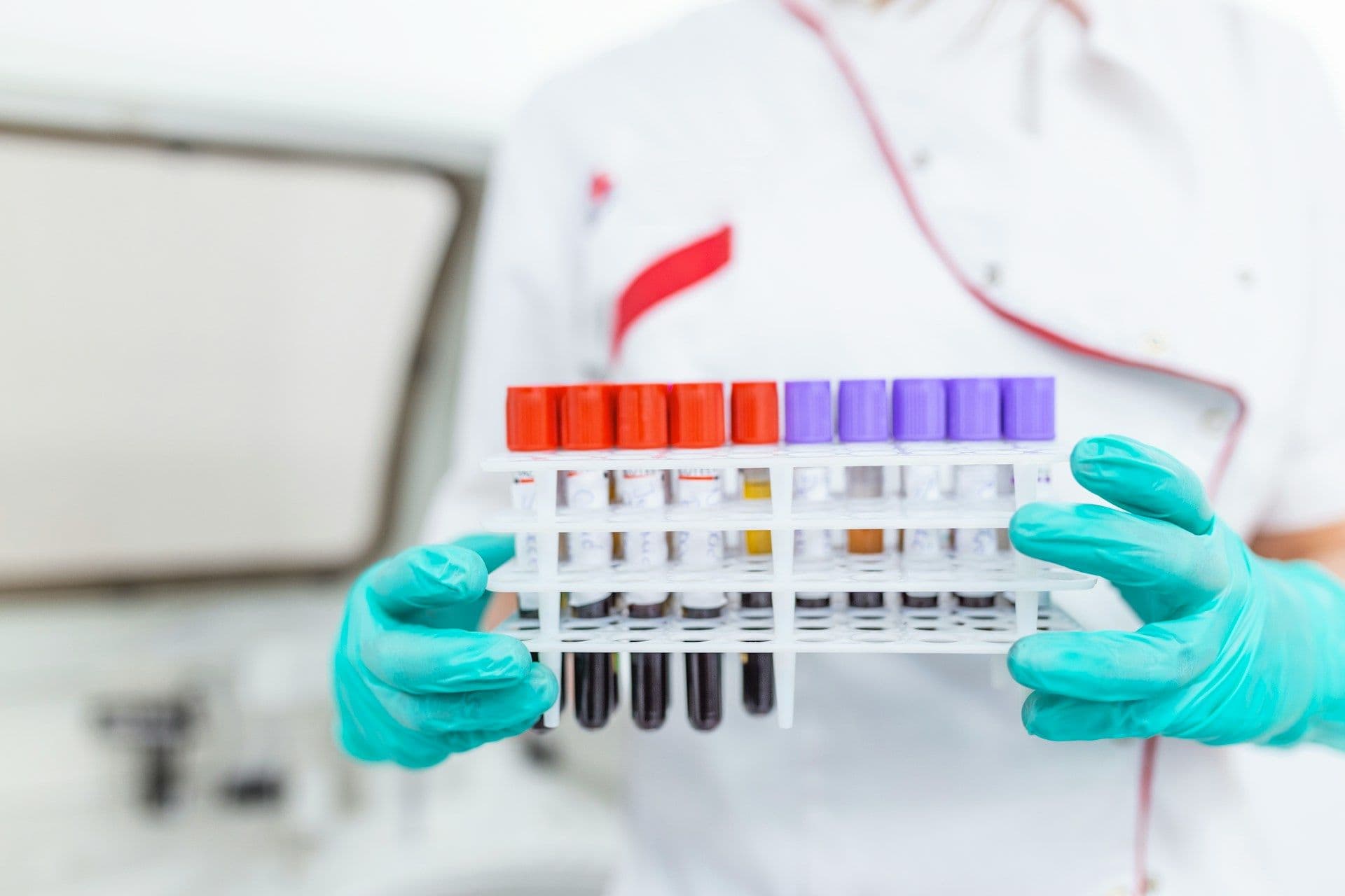 Laboratory analisys in Luxembourg