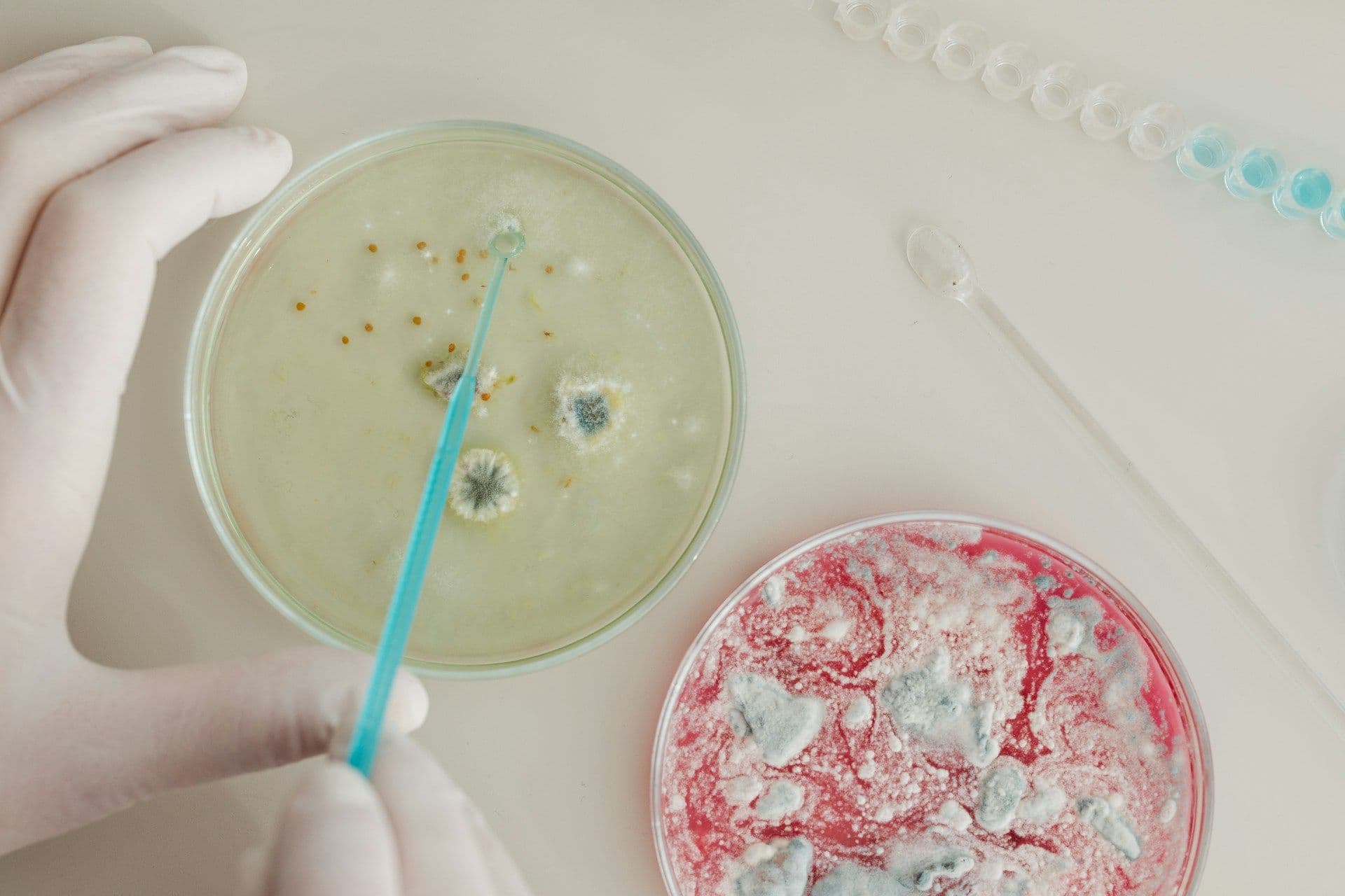 Bacterial infection in Luxembourg